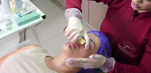 Representação do método